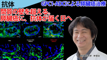 ピックアップ研究（医療機器）