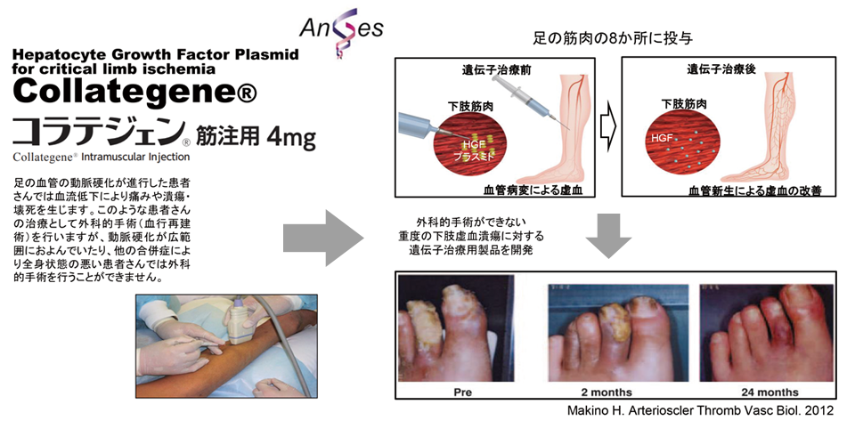 コラテジェン筋注用4㎎