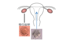 バイアユーアール